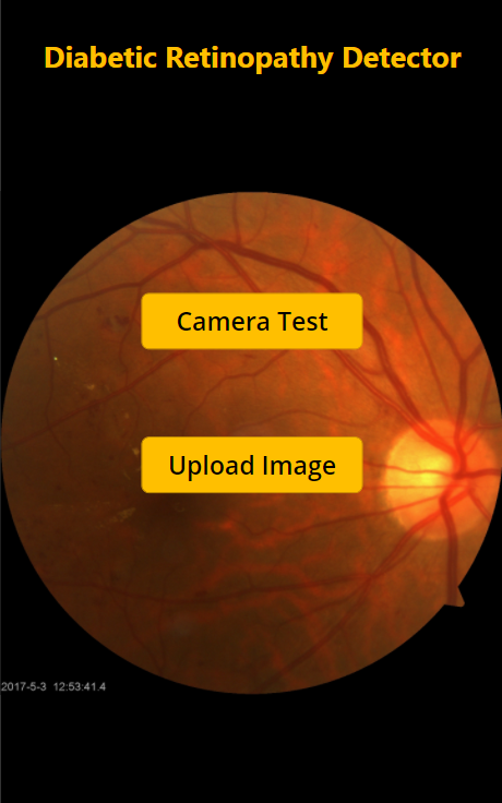 eye image